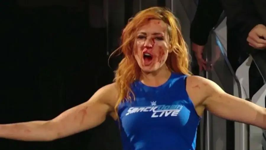 Becky Lynch