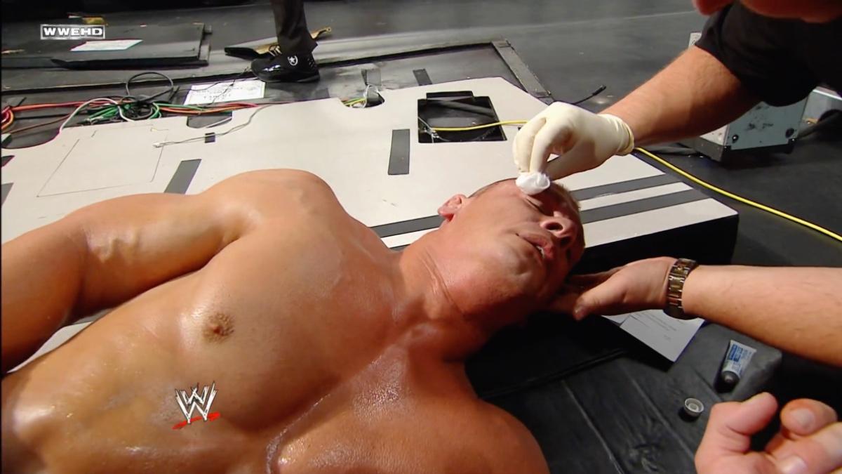 John Cena being tended to by a WWE doctor, who is robbing cotton wool across a cut above his eye