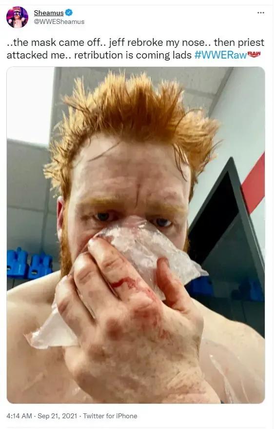 Sheamus nose tweet september 2021